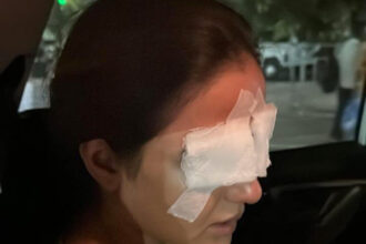 Jasmine Bhasin battles corneal damage after lens mishap, leaves her in pain : Bollywood News