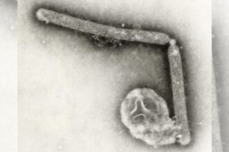 Canada reports first human case of bird flu after teen tests positive