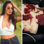Kashmera Shah narrowly escapes “freak” accident in the USA, shares photos of blood-soaked tissue: “Kuch bada hone wala tha…” : Bollywood News