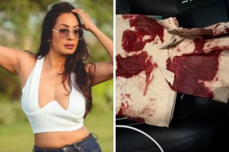 Kashmera Shah narrowly escapes “freak” accident in the USA, shares photos of blood-soaked tissue: “Kuch bada hone wala tha…” : Bollywood News