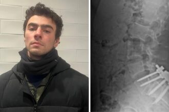 ‘Luigi Mangione’s back pain so intense, he couldn’t date or get physically intimate,’ former landlord reveals