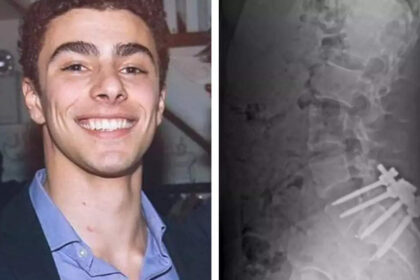 ‘Surgery was painful’: UnitedHealthcare CEO killer Luigi Mangione’s social media posts indicate about his health struggles